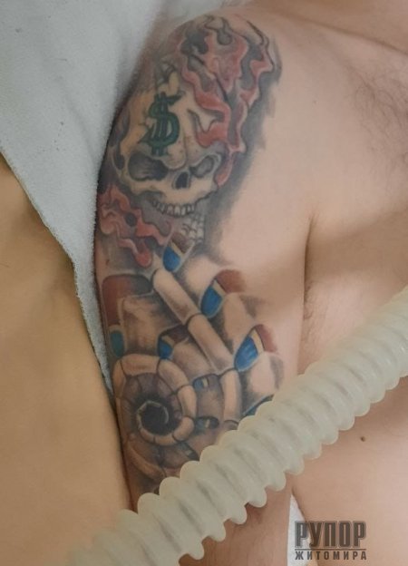           -     