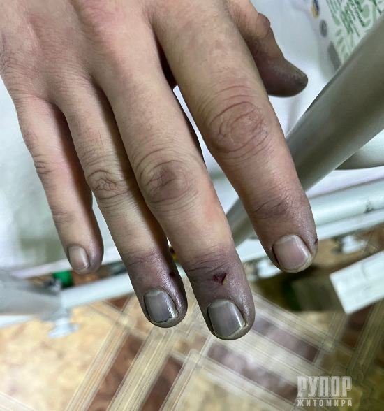 ���������� ������������� �������� ������ ������������ �������� �������, ��� ���� �� ����������� ������